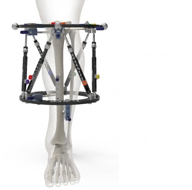 Kość rośnie w naszym szpitalu